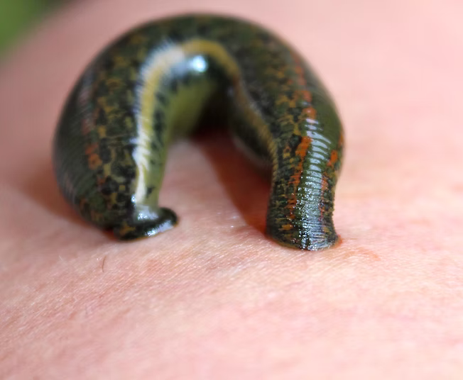 Raktamokshana: Bloodletting